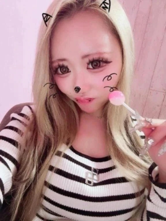 怪我しちゃった。(´；ω；`)